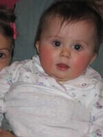 Rosy cheeks